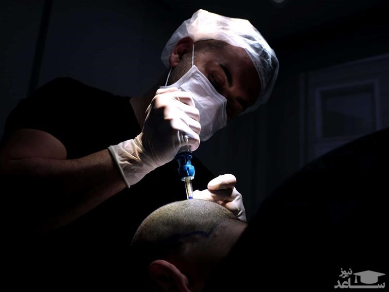 انتخاب بهترین کلینیک کاشت مو ایران توسط انجمن پیوند موی ایران