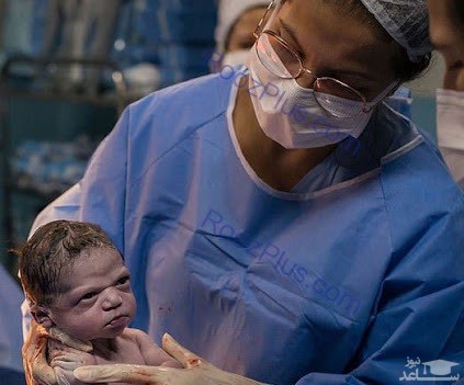 نگاه عجیب این نوزاد هنگام تولد، جهانی شد!