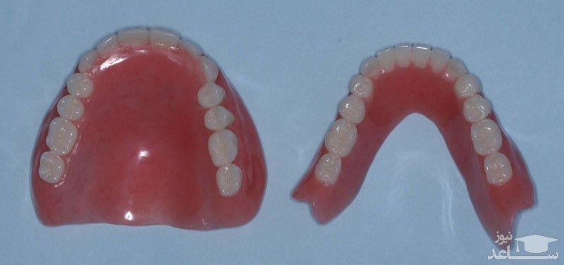 نکاتی مهم درباره ی پروتز دندان یا دندان مصنوعی