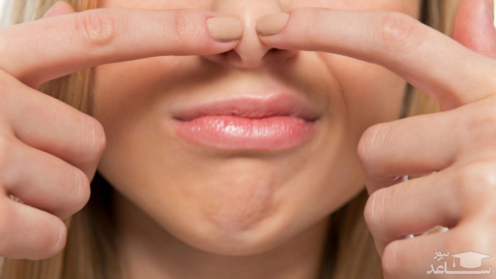 جوش های سر سیاه را با روش های خانگی از بین ببرید