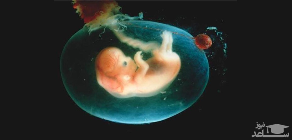 دلایل کم شدن مایع آمنیوتیک در بارداری