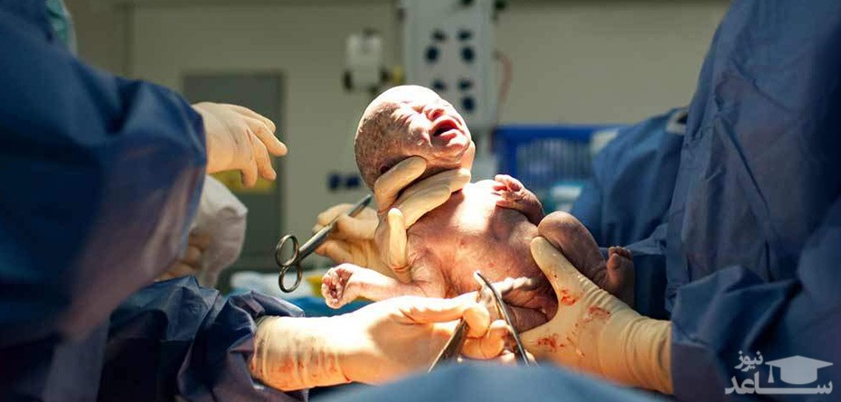 روش های کاهش درد در زایمان طبیعی