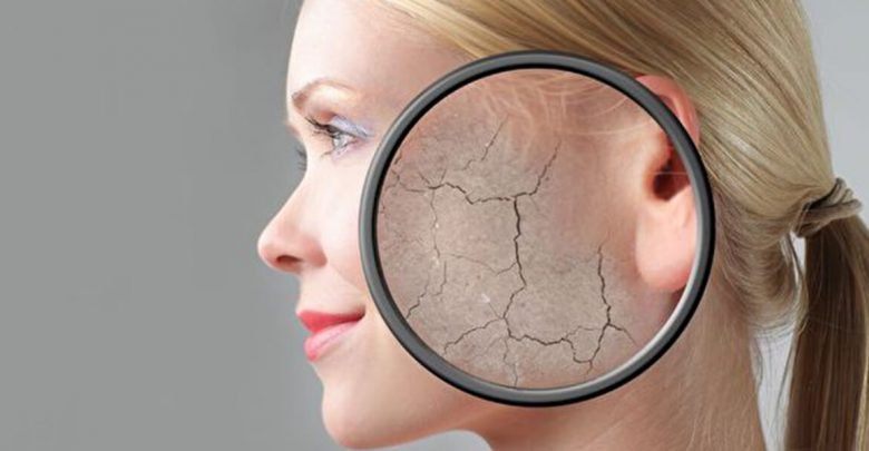 اگر پوست خشک دارید بخوانید