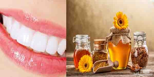 تأثیر عسل بر دندان و لثه