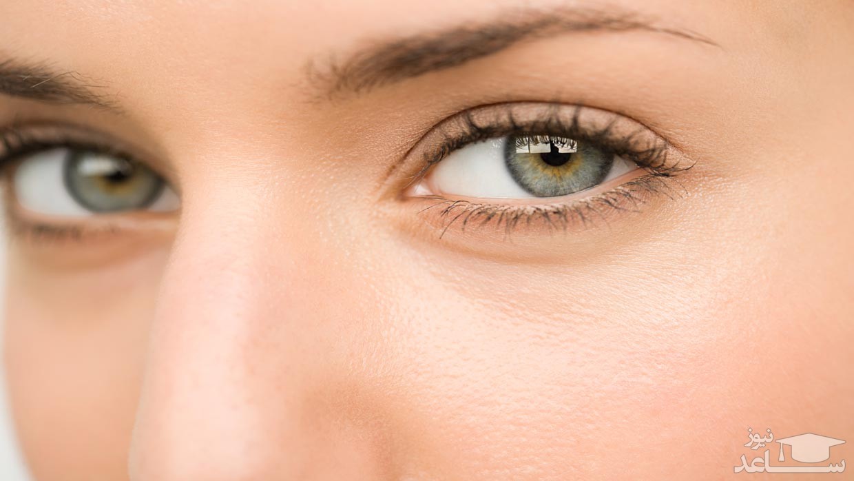 مهم ترین علت های ورم چشم چیست؟
