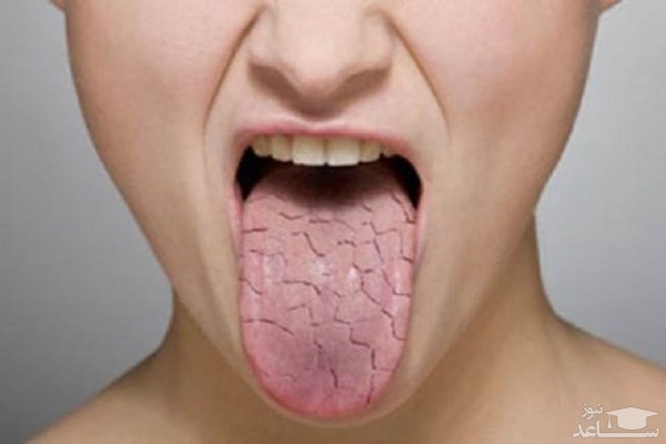 میزان و نحوه مصرف سویملین