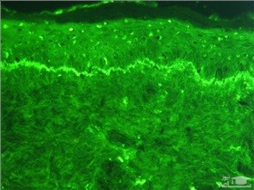 علت تغییر رنگ پوست در حاملگی