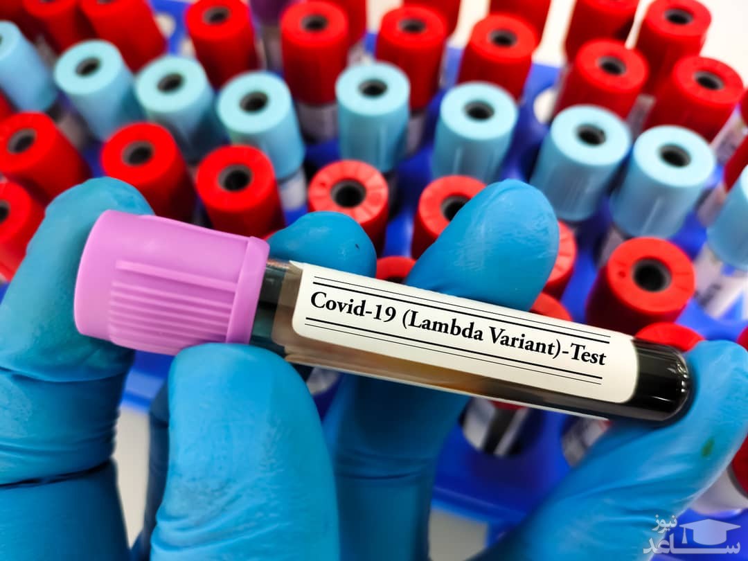 احتمالا تا ۶ ماه آینده پاندمی کووید-۱۹ به اندمی تبدیل خواهد شد