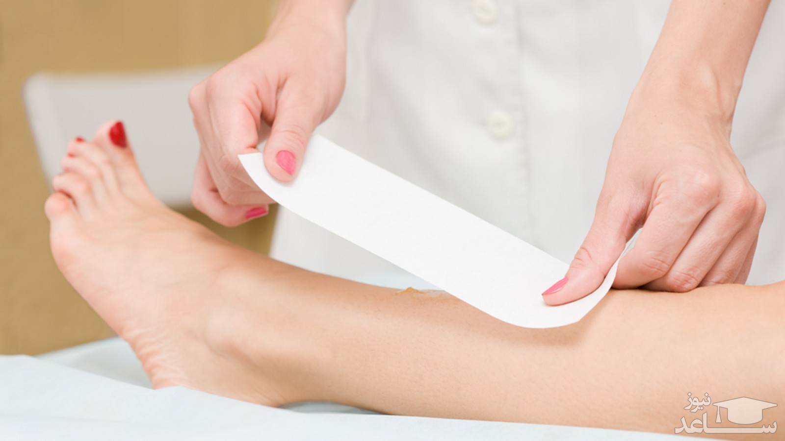 انجام اپیلاسیون