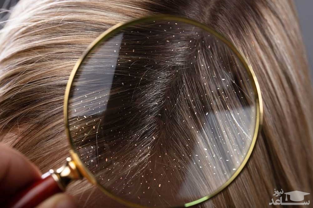 خرید شامپو ضد شوره و ریزش مو ایرانی و خارجی