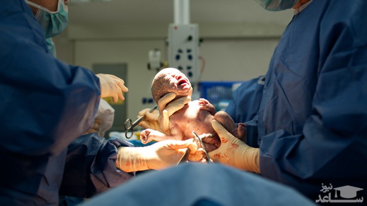 شرایط زایمان طبیعی بعد از سزارین