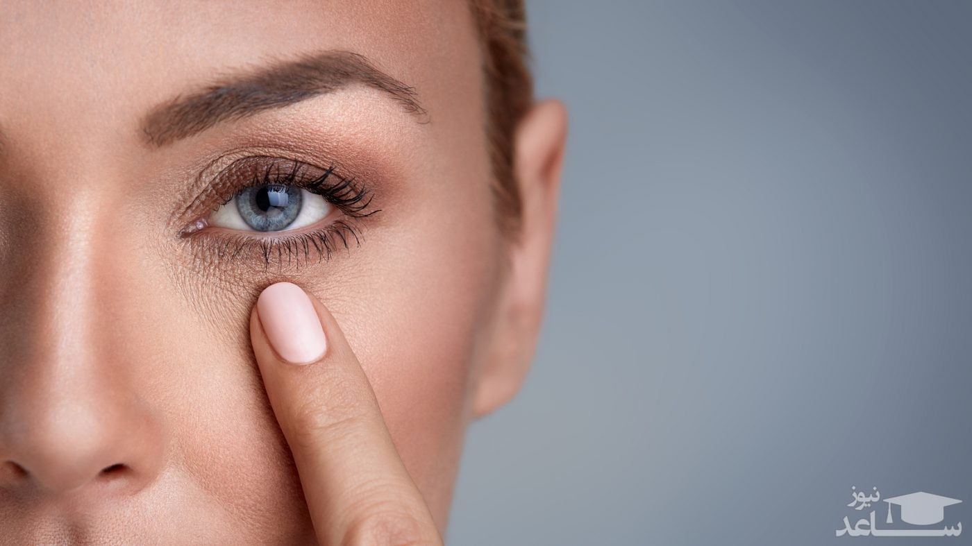 9 علت تیرگی زیر چشم ها