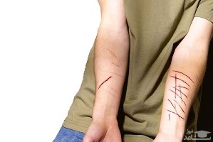 منشا خودزنی یا خون بازی بین دانش آموزان در مدارس