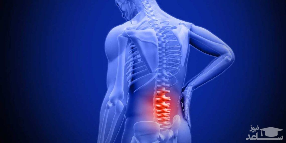 علائم دیسک کمر