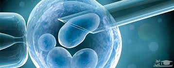همه چیز درباره لقاح آزمایشگاهی یا لقاح خارج از رحمی IVF  