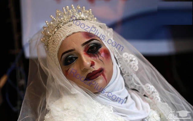 (عکس) عروس‌های کتک خورده با سر و صورت کبود