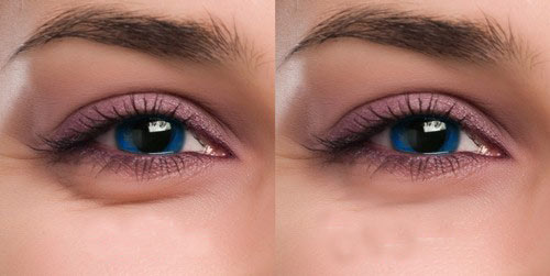 چگونه پف زیر چشم را از بین ببریم؟