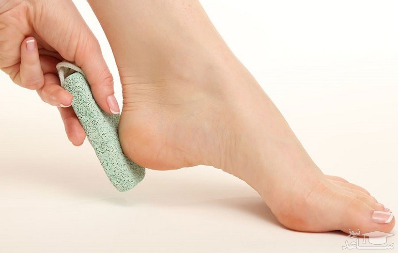 درمان خانگی ترک پا