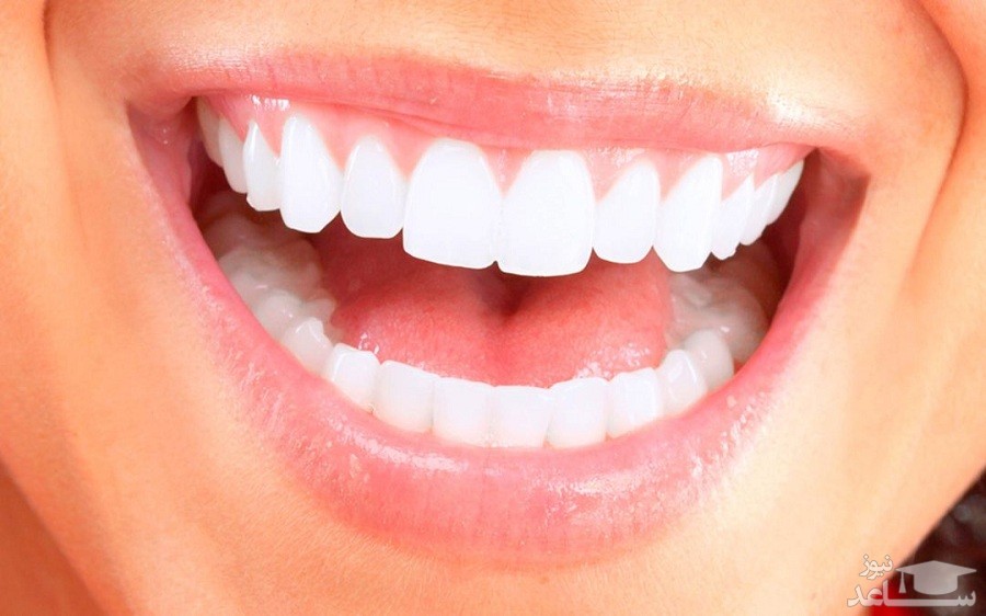 روش های خانگی درمان بیماری های لثه