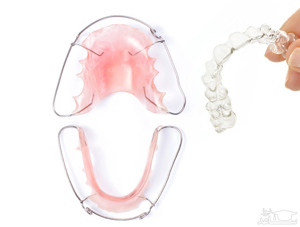 الاینر شفاف در دندان پزشکی