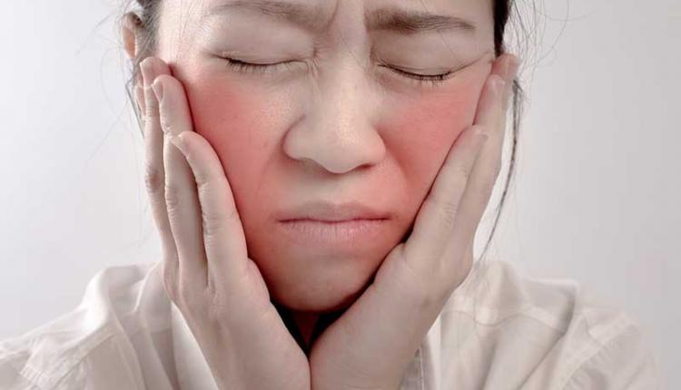 روش هایی برای جلوگیری از سرخ شدن گونه ها