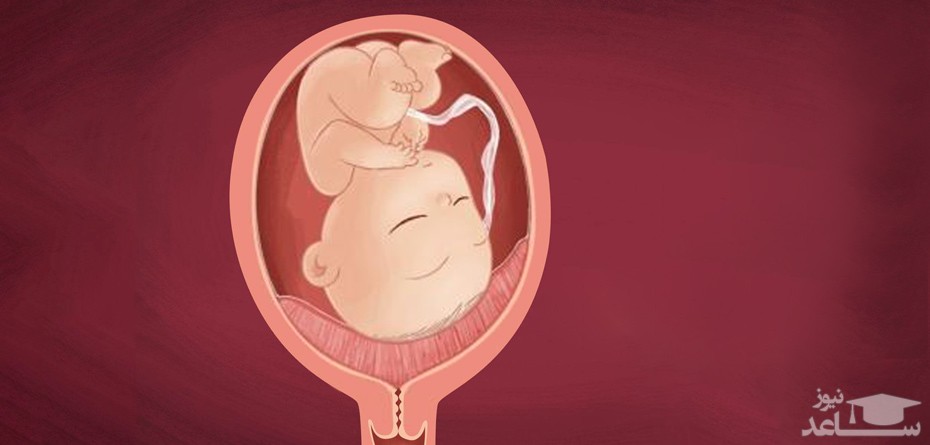 آشنایی با جفت سرراهی یا پلاسنتا پرویا در بارداری