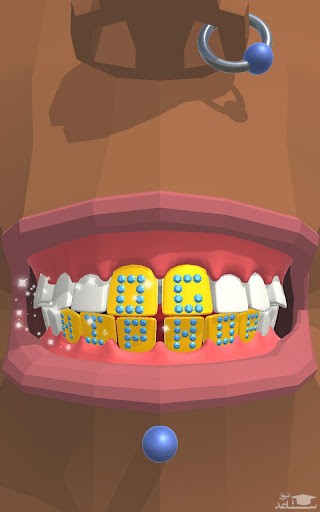 بازی Dentist Bling