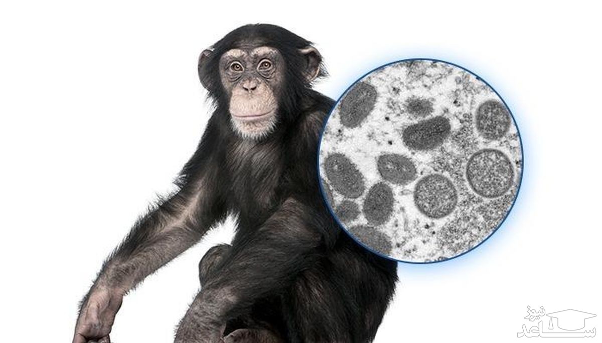 شناسایی ۶ بیمار مشکوک به آبله میمونی در ایران