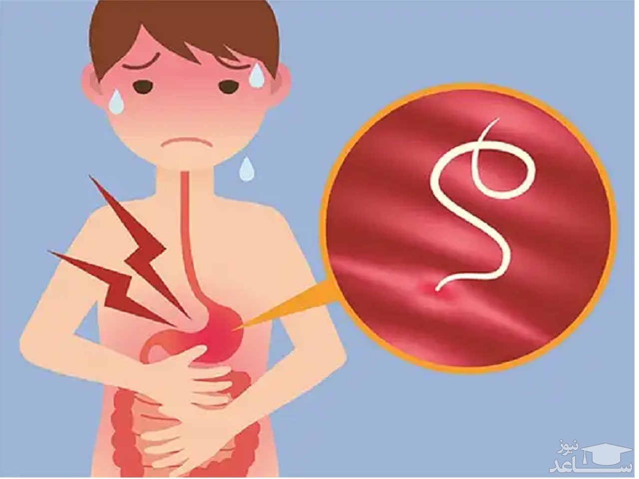 موارد منع مصرف و تداخل دارویی پرازیکوانتل