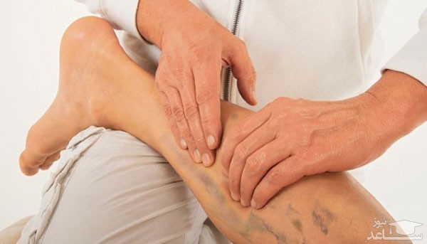 میزان و نحوه مصرف کرم ونوویتال