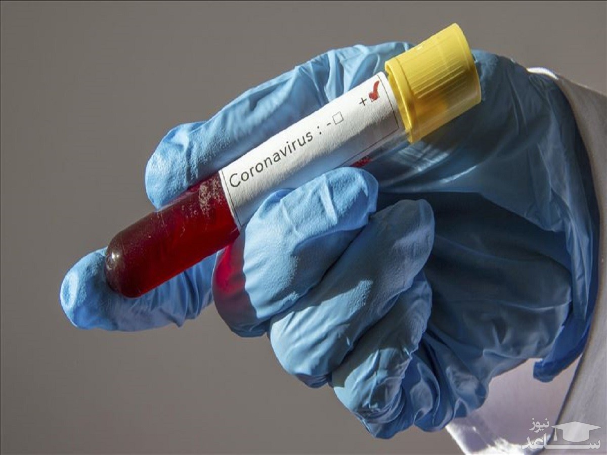 کانادا انجام اولین آزمایشات بالینی واکسن "کووید-۱۹" را تایید کرد