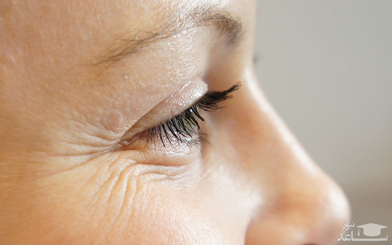 رفع چین و چروک دور چشم با چند ترفند ساده آرایشی