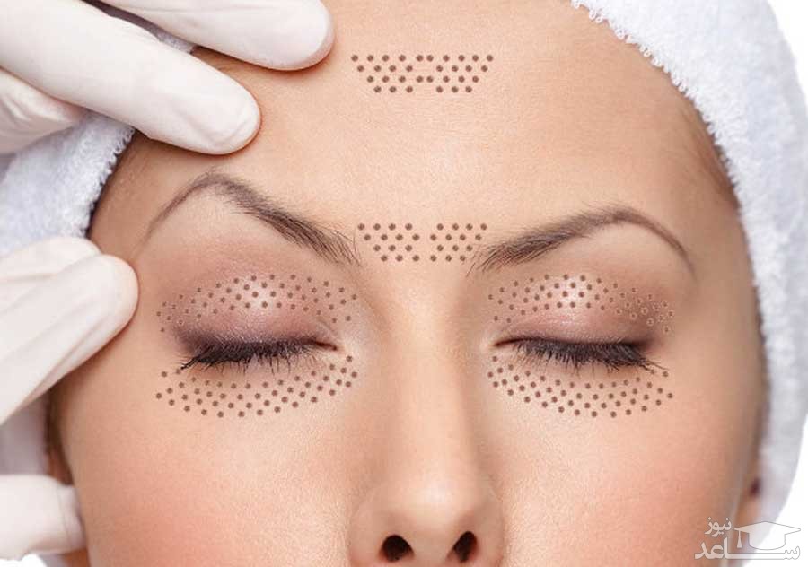 همه چیز در مورد پلاسما تراپی یا پلاسما جت