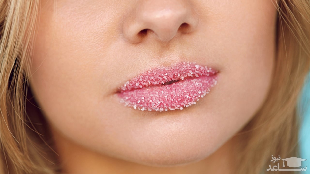 خشکی پوست اطراف دهان از چیست؟