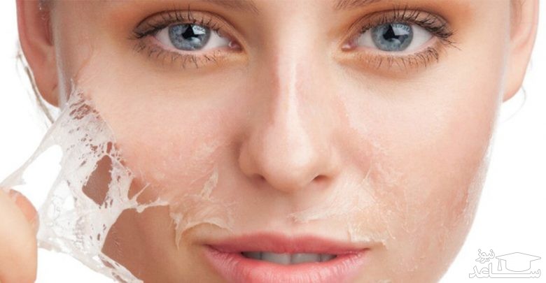 پیلینگ و افزایش زیبایی!