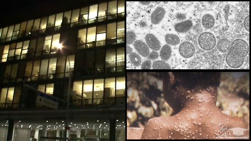 تعداد مبتلایان به آبله میمون در نیویورک افزایش یافت