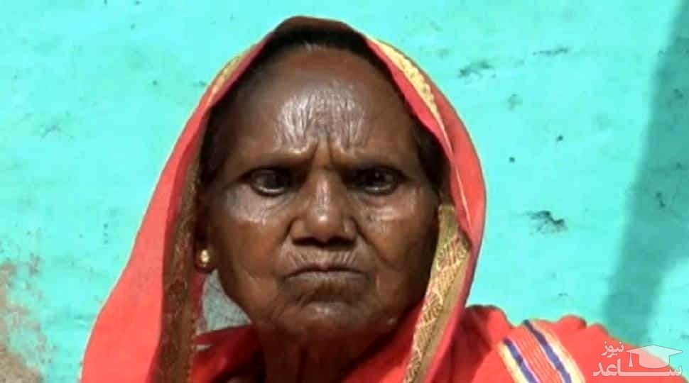 بینایی چشمان پیرزن 70 ساله نابینا پس از تزریق واکسن کرونا!