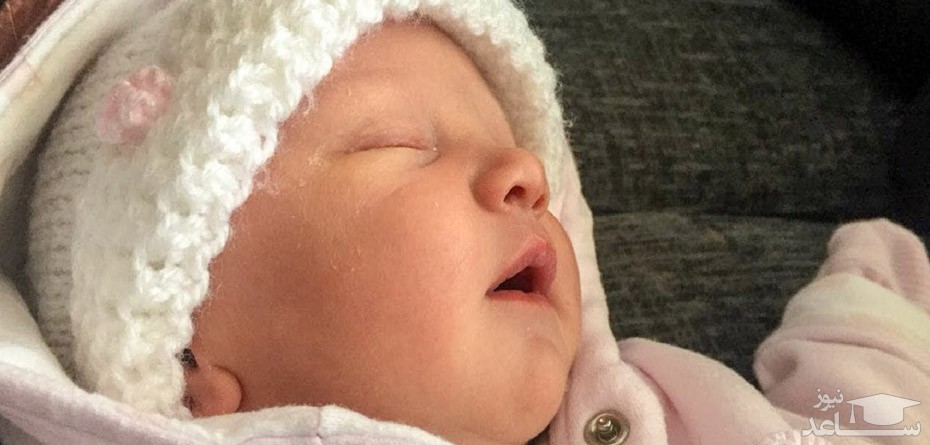 آشنایی با بیماری لیپوپروتنوسیس در نوزادان و کودکان