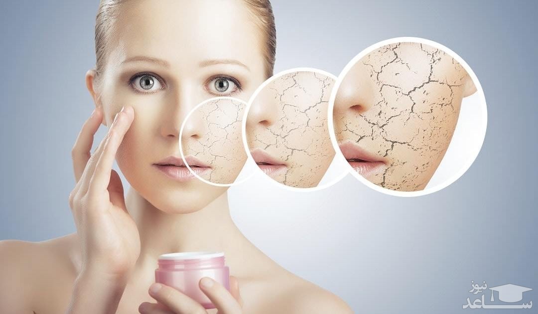 نکاتی برای جلوگیری از خشکی پوست
