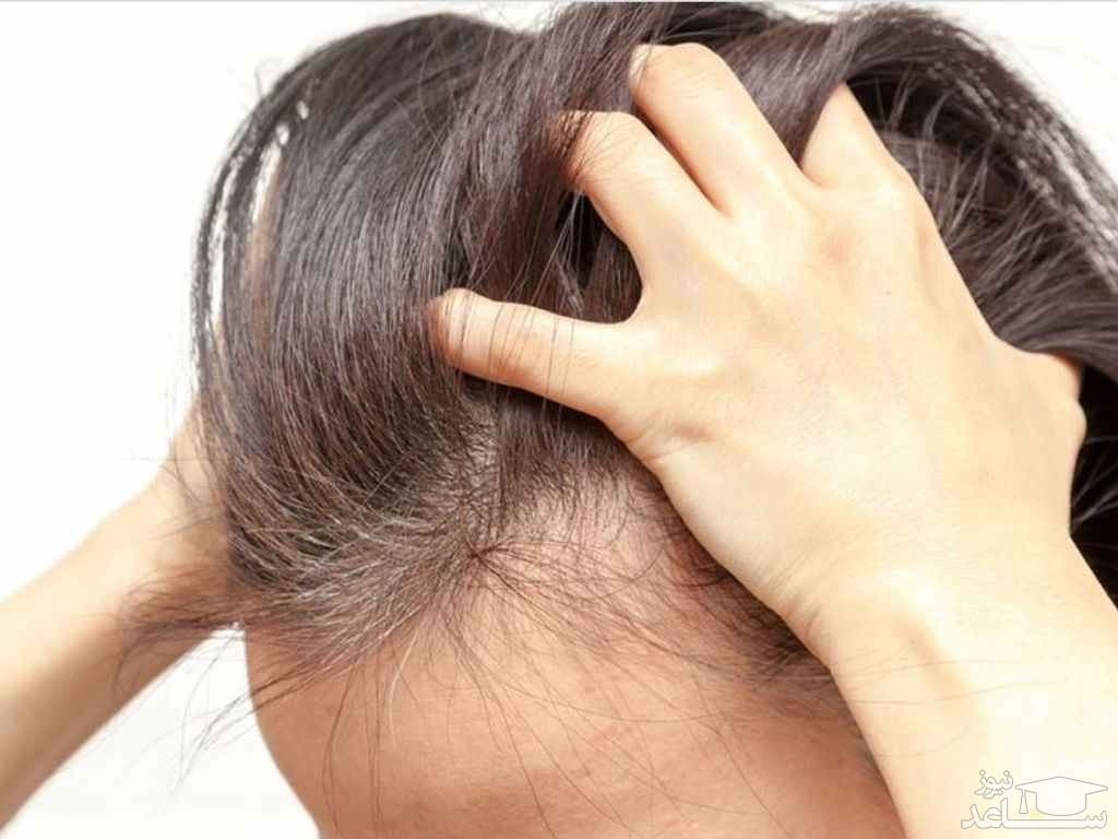 آیا موهای قوی تر و سالم تری می خواهید؟ این 10 نکته را امتحان کنید