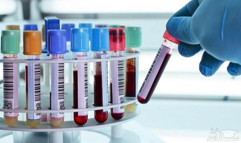 چگونه جواب آزمایش خون را معنی کنیم؟