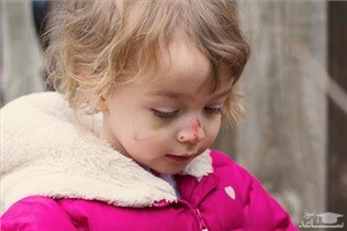 پبشگیری از زخمی شدن بدن کودک با اشیا نوک تیز