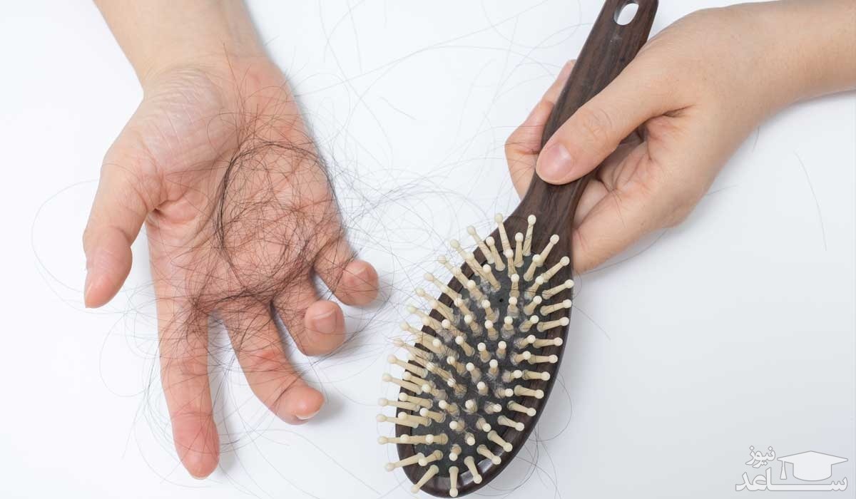 راهکارهایی برای درمان ریزش مو بعد از بارداری و زایمان