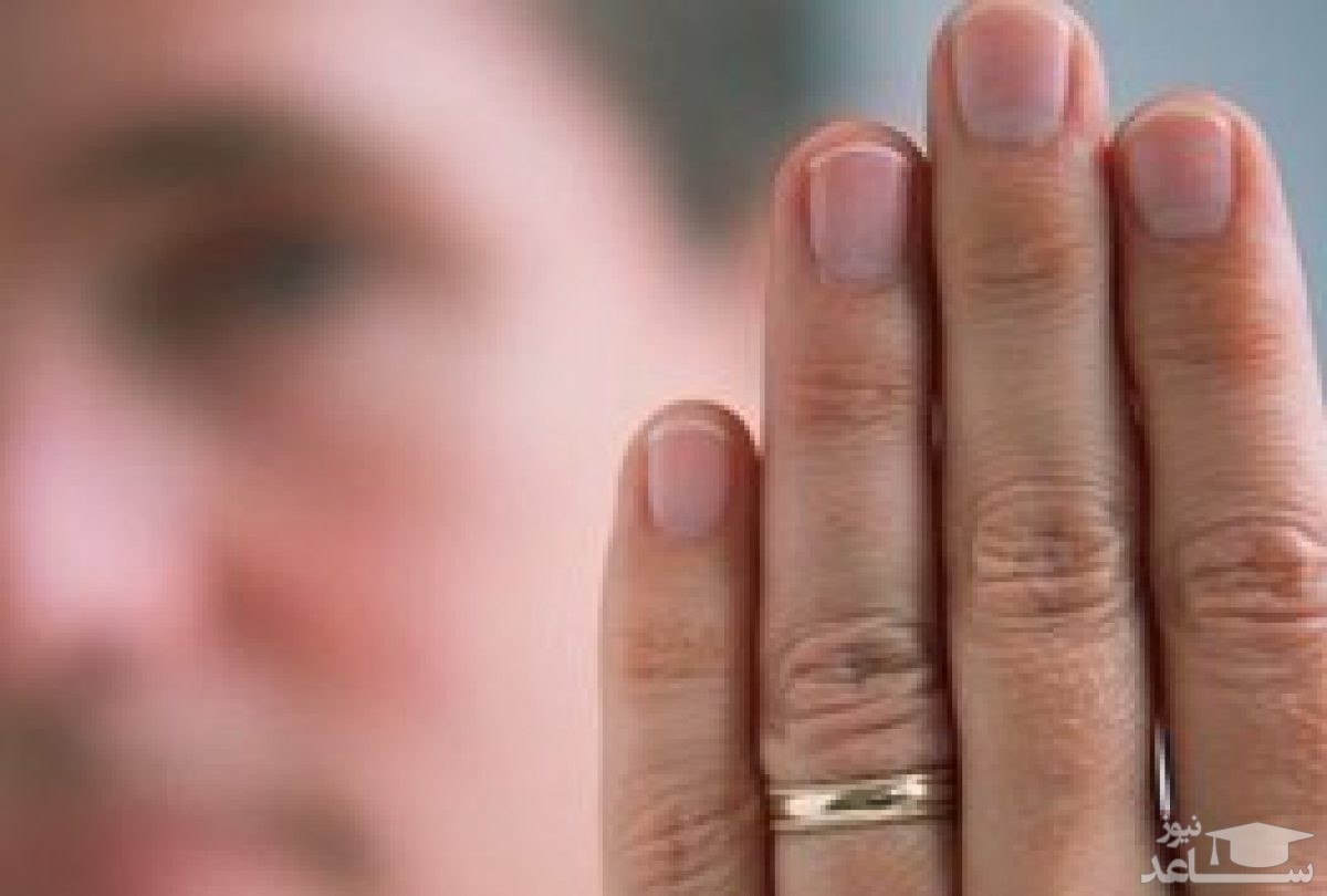 تاثیر طول انگشت حلقه بر افزایش فوتی‌ها بر اثر کرونا در مردان