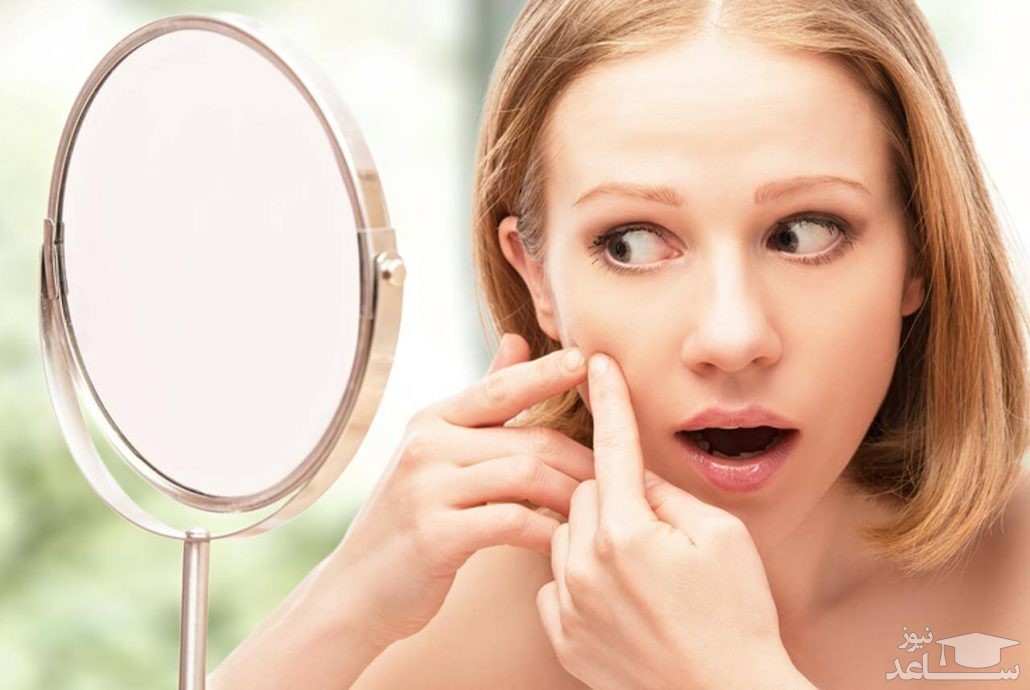 ماسک‌ های عسل برای بهبود جوش های سر سیاه