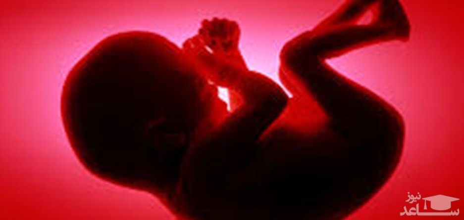 روش های درمان عواقب بد و نامطلوب بارداری