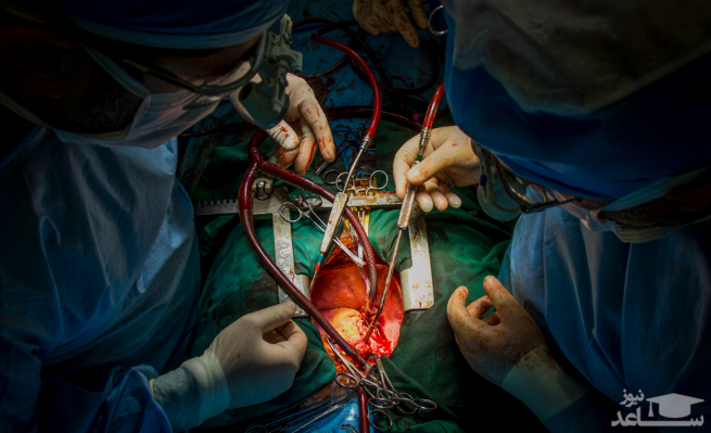 سفر قلب پیوندی، کوچه فلافلی ها و ...