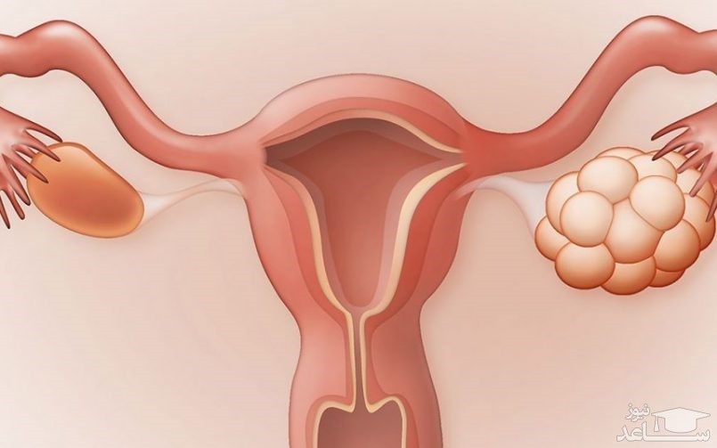 آشنایی با خواص میوه و گیاهان دارویی برای زنان