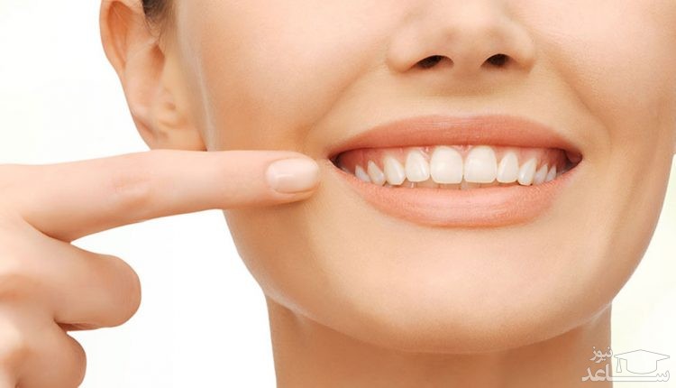 رفع پلاک دندان در خانه با چند روش ساده