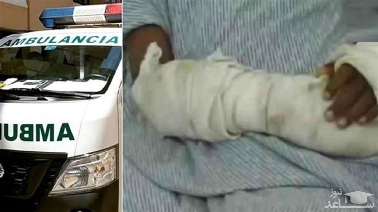 زنده زنده سوزاندن یک دختر توسط مادرش!